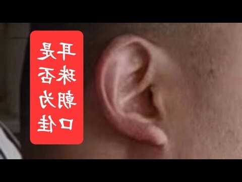 耳珠朝口 面相
